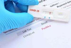 IATA lo demuestra: Las pruebas de antígenos son tan eficaces como las PCR